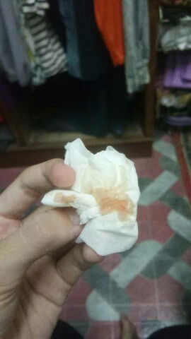 Maaf gmbar sedikit kotor .. ni masih darah nifas kn .. pantang hari 46 .. anak pertama xtau sgt ..