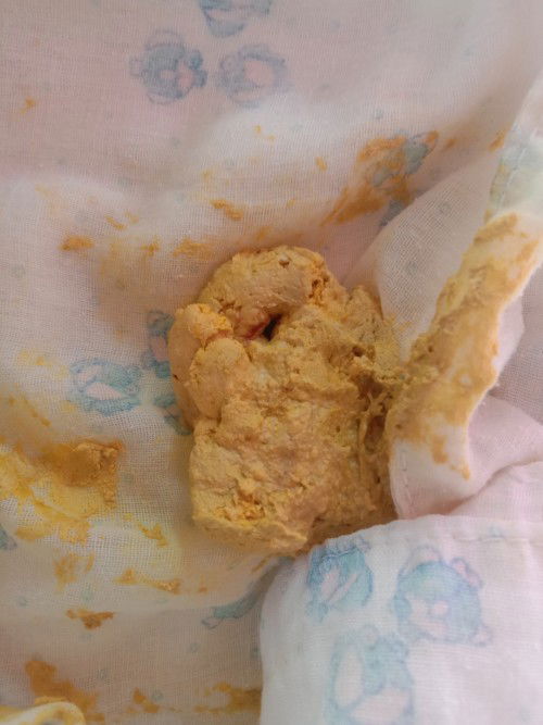 ลูก4เดือนกินนมผงค่ะ