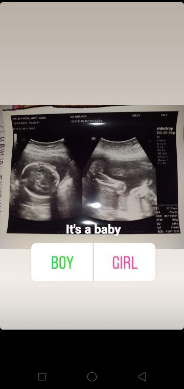 Jenis kelamin baby 😍