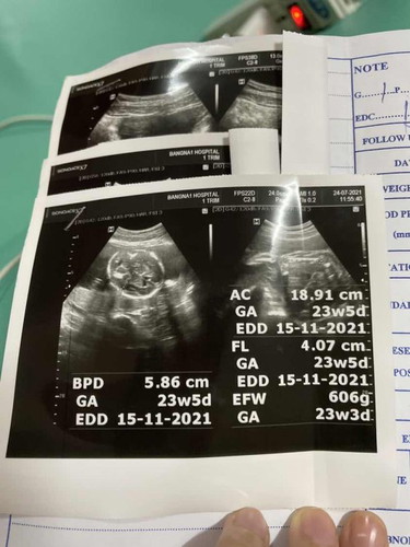สอบถามแม่ๆหน่อยค่ะ ครรภ์ 23 วีค ลูกโตแค่นี้ ผิดปกติไหมคะ กังวลกลัวเขาโตไม่ตามเกณฑ์ หรือควรกินอะไรบำรุงดีคะ