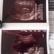 แม่ๆบ้านไหนดูออกมั้ยคะว่าชายหรือหญิงคะ ช่วยดูเพศให้หน่อยคะแม่ๆ