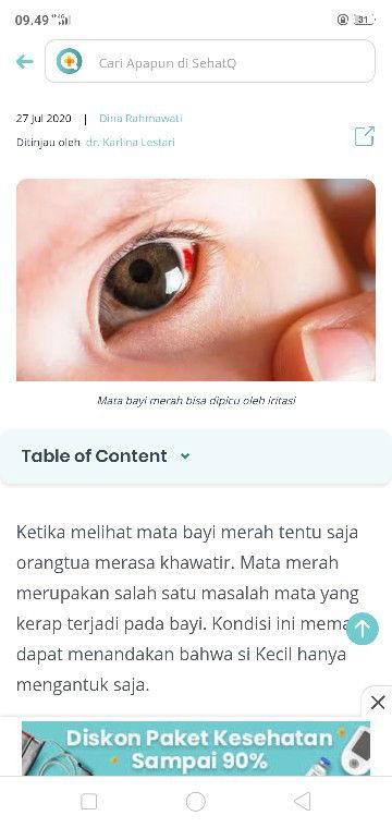 Garis merah disekitar mata