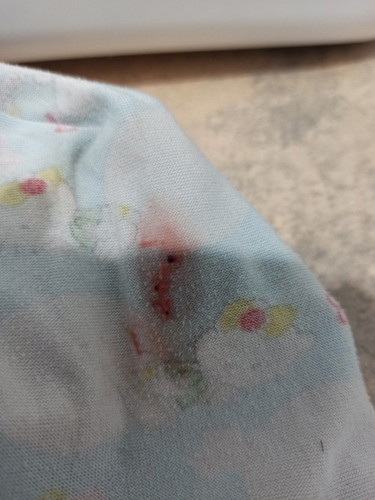 IE - may blood at mahapdi