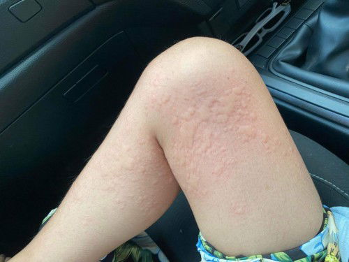 ตั้งครรภ์มือใหม่