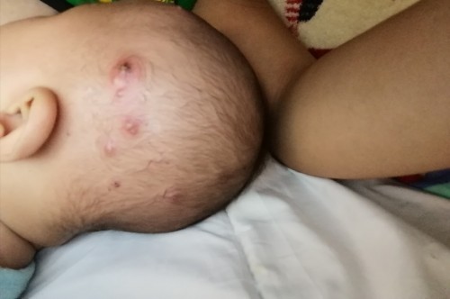 lumps in my baby's head