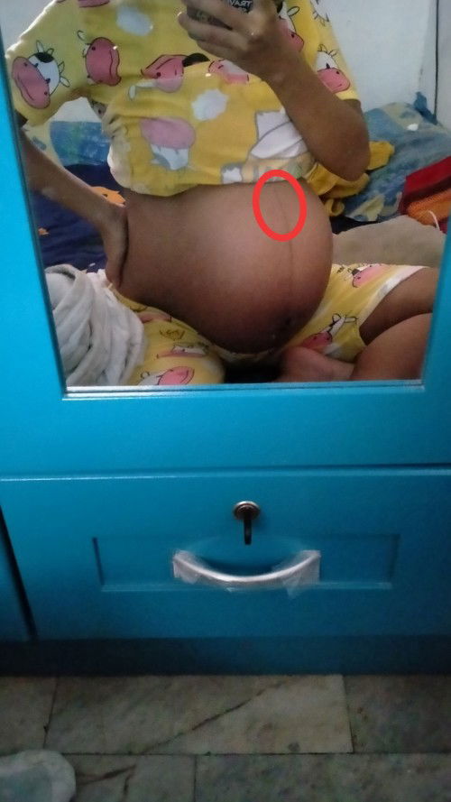 แม่ๆบ้านไหนเคยเป็นบ้างคะ