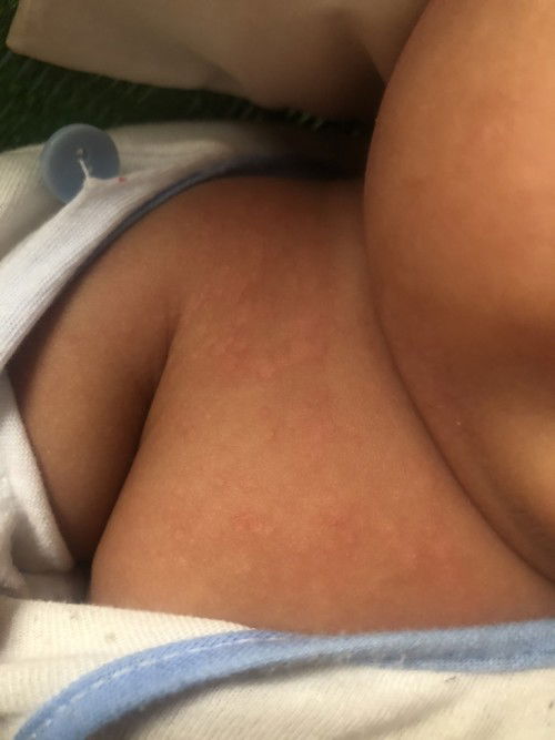 cho em ý kiến của các mẹ bỉm