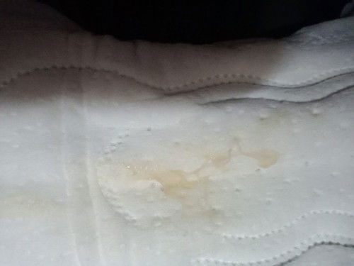 ตั้งครรภ์38w5b