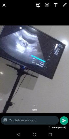 Ngeflek Darah 2Hari Ini