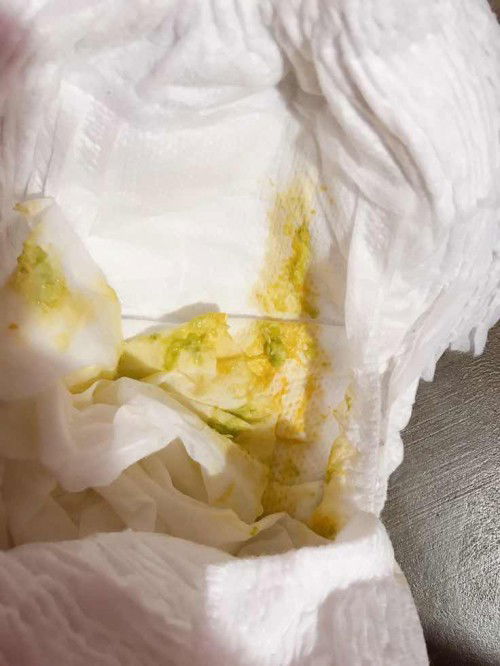 Bé ba tháng tuổi