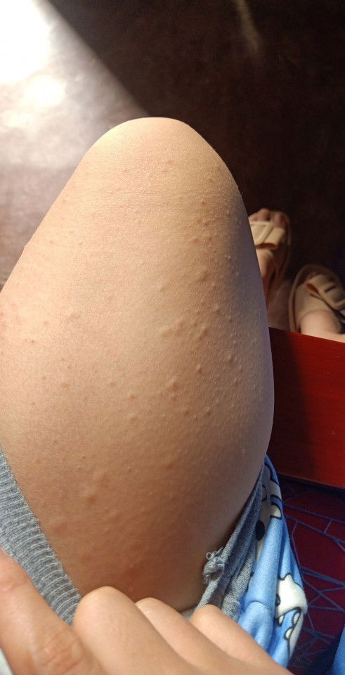 #Hội những người  mang thai