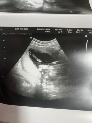 แม่ๆช่วยดูหน่อยค่ะว่าน้องเพศไหน