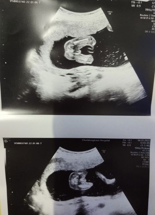 ผู้ชายชัวร์ไหมคะ?😅