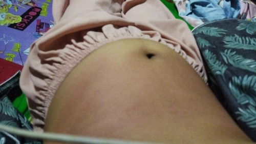 Bun ada yg sma kah, perut gatal² bagian atas pusar? Usia khamiln 14w.