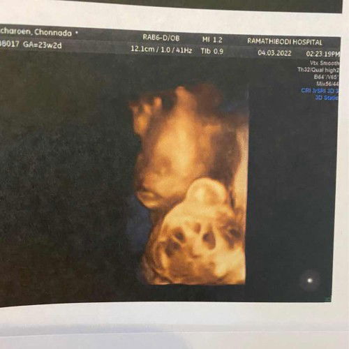 หนุ่มน้อย ในวัย 23w2d ศิษย์อาจารย์ อดิเทพ รามาพรีเมี่ยม คร้าปป