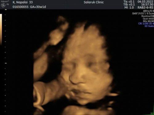 30 วีค1 วัน น้ำหนัก1317 น้อยไปไหมคะ