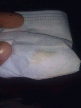 ตกขาวหรือมูกคะ ข่วยตอบหน่อย