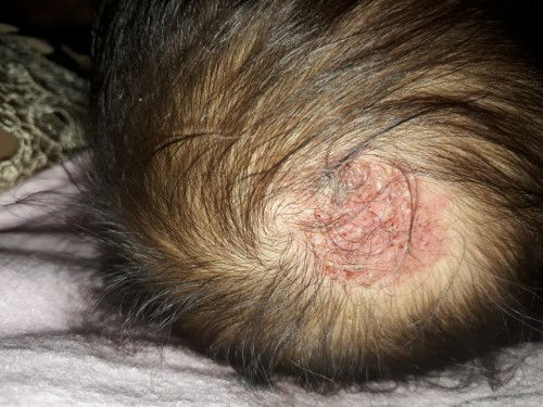 Ingin anak saya cepet sembuh