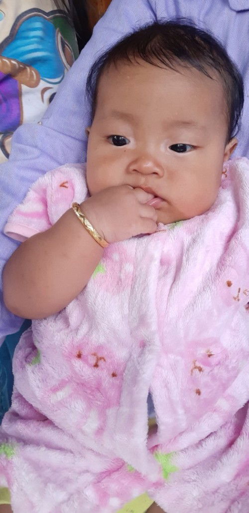 Bunshay anak saya 6bln  tapi masih suka keluar tai mata warna keruh hijau kekuningan pekat ,solusi