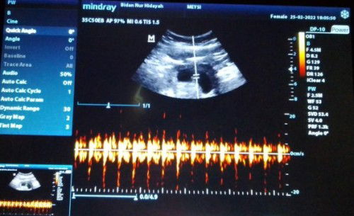 Mohon dijawab ya bucan❤️