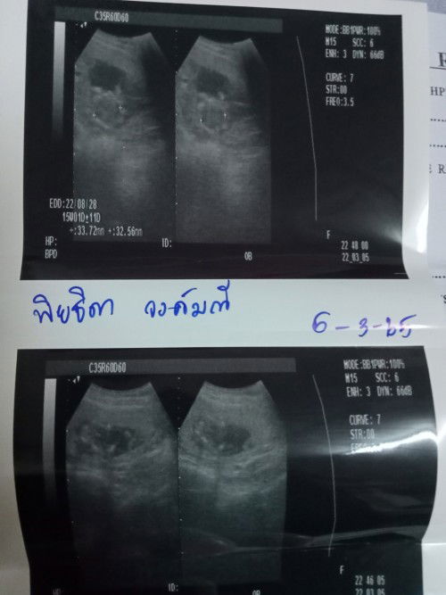 ทัองแรกอยากรู้หลายๆคอมเม้นค่ะ ช100%ไหมค่ะ