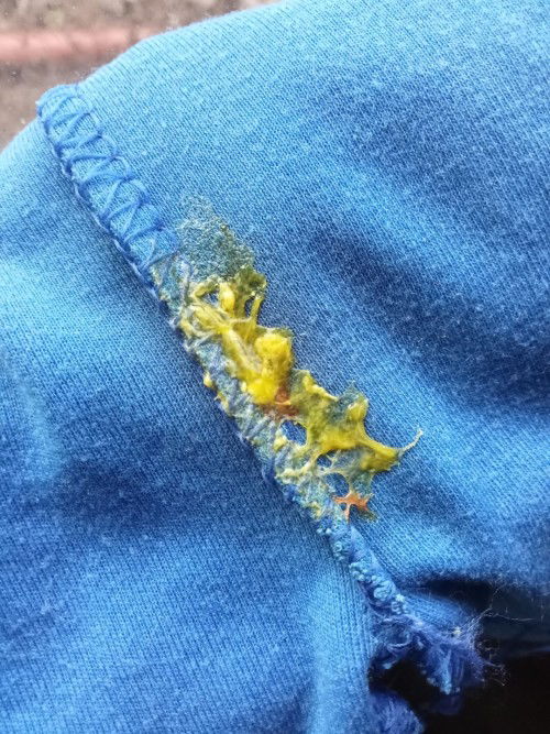 Pup bayi 2bulan ada lendir darah