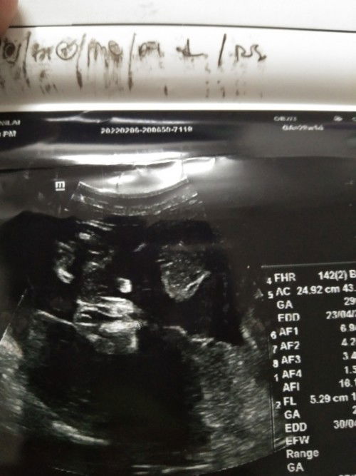 Sekadar ingin kepastian