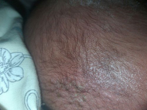 Kepala bayi berketombe