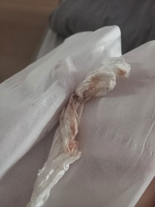 37 week keluar lendir dan flek 
Perut mules