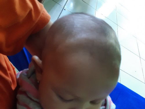 Kaya garis benjol depan kepala