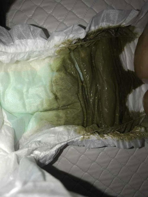 Pasal warna najis baby