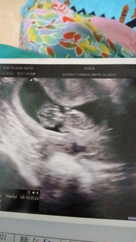 Hasil USG Ku 10Week