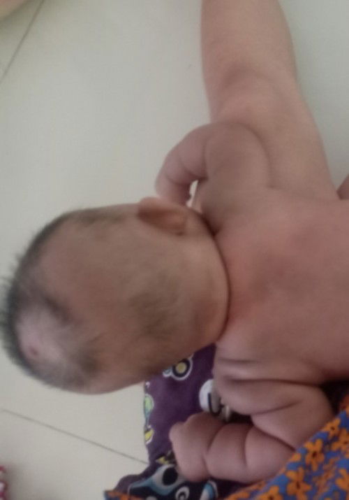 ผมของลูกน้อย