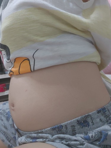 แม่บ้านไหนท้องเล็กเหมือนเราบ้างคะ