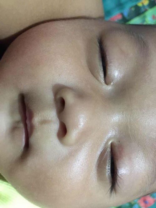 Mata kanan kiri beda