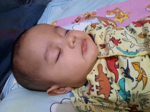 Bayi didiagnosa IUGR
