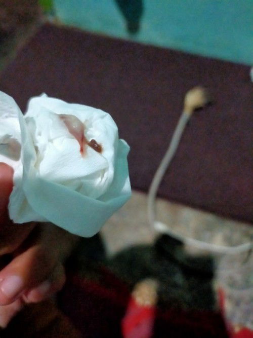 Mengeluarkan keputihan berbarengan dengan darah
