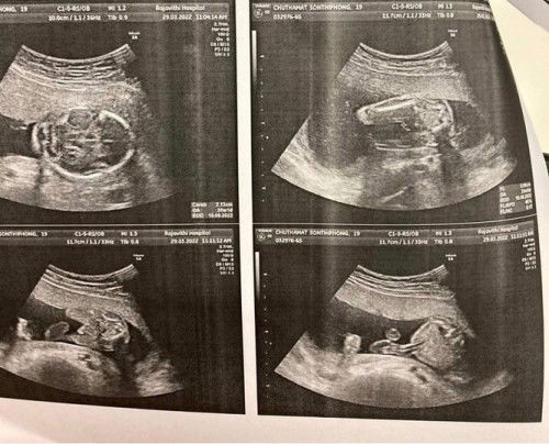 เพศลูก🥰ชาย/หญิง