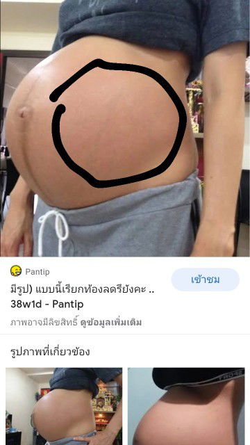 ท้อง31+5วีค