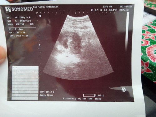 USG 8 minggu