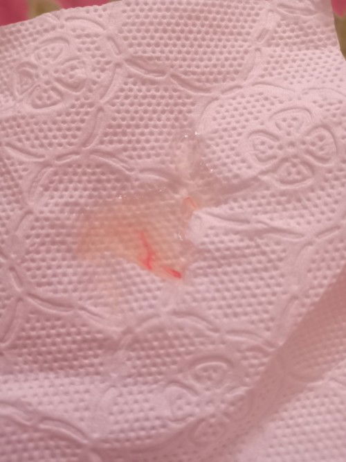 อยากถามแม่ๆหน่อยคะ
เมือคืนนอนไม่ได้เลยคะปวดท้องคล้ายประจำเดือน ปวดเป็นระยะ เป็นอาการเจ็บท้องคลอดป่าว