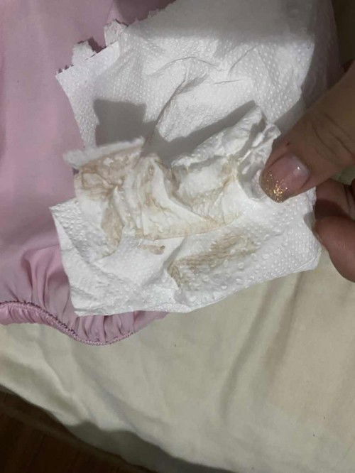 ตั้งครรภ์ได้ 26 สัปดาห์ แล้วมีแบบนี้ออกมาเป็นสีน้ำตาล เกิดจากอะไรคะ