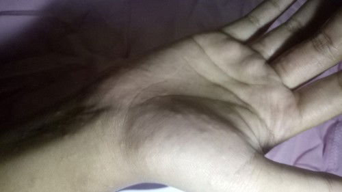 Liburan malah jadi penyakit