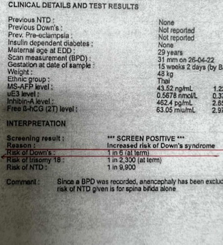ตรวจเลือดแล้วแบบเจาะเลือดที่ รพ.หมอบอกว่าเสี่ยงเป็นดาวน์สูง !!