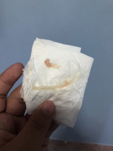 ถามแม่ๆหน่อยค่ะ