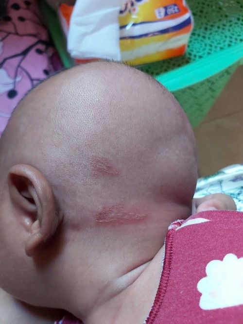 kemerahan agak berair