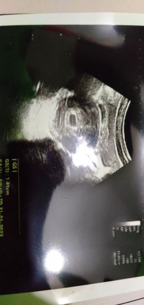 Mohon Pencerahannya Bunda2🙏