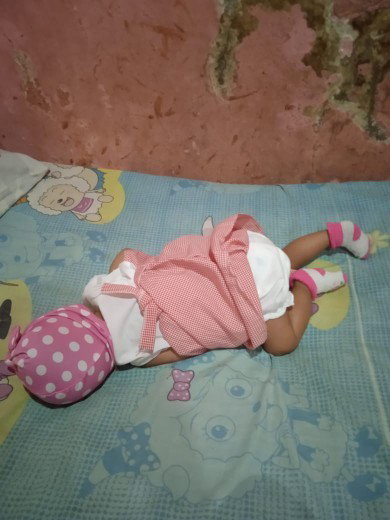 Baby tengkureb