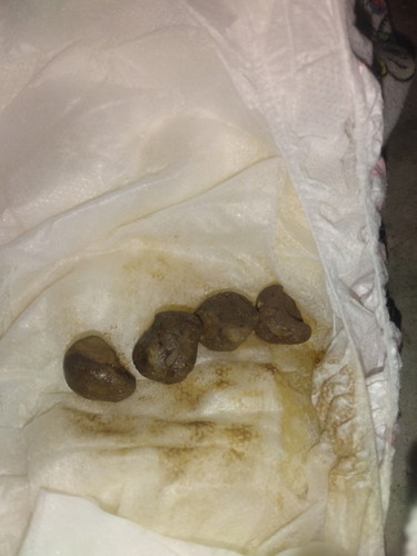 Baby Poop💩