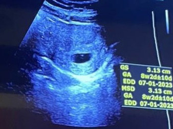 Keliru bacaan minggu di apps & ultrasound klinik